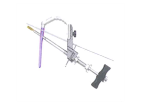 Chấn thương xương đùi